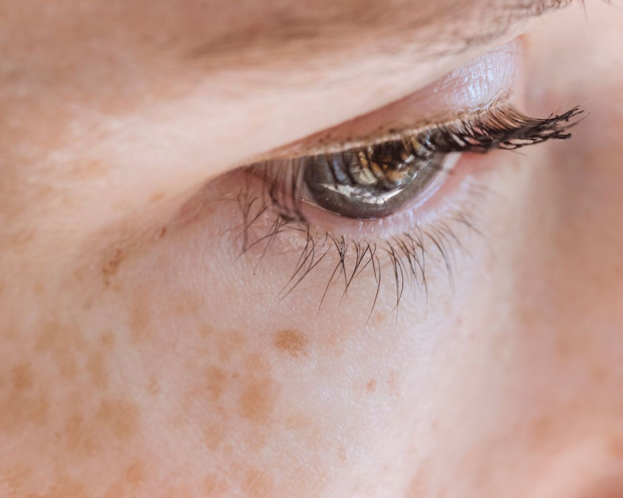 Not Washing Face At Night Ages You | Problem Explained & Solved