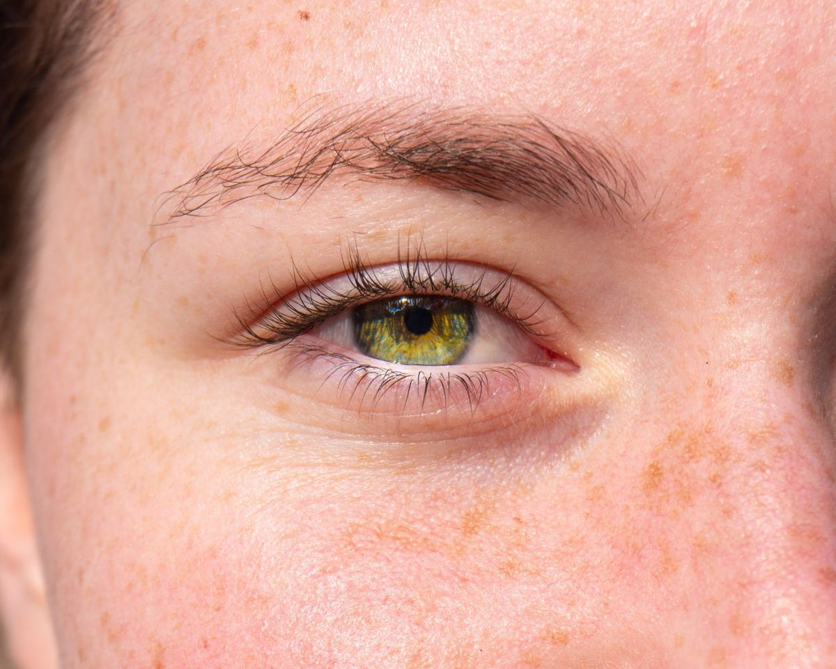 Best Hydrosol For Hyperpigmentation - Experts Recommendations